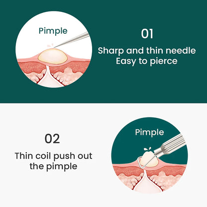 MR.GREEN doppelseitige Aknenadel: Schritt 1 Nadel punktiert, Schritt 2 Schlinge drückt Pickel hygienisch heraus.